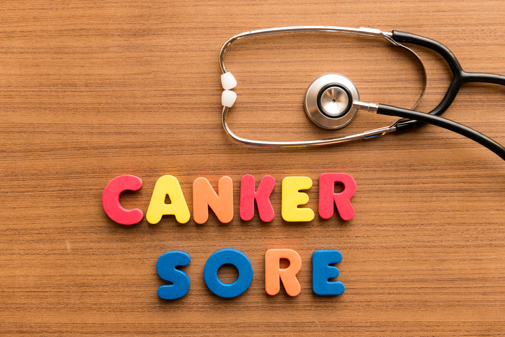 Are Canker Sores Contagious?