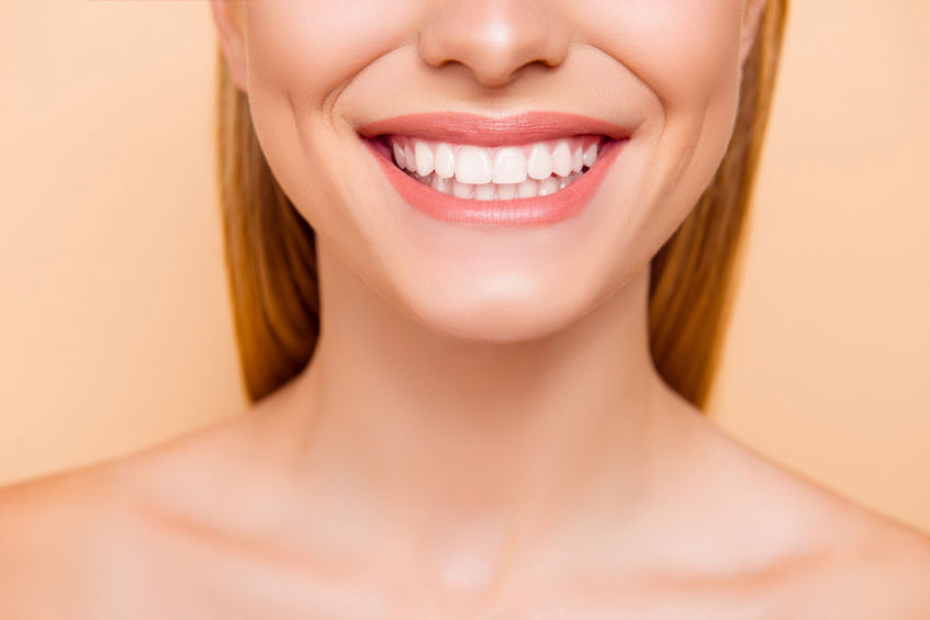 Dental Veneers Aren’t Just for Celebrities