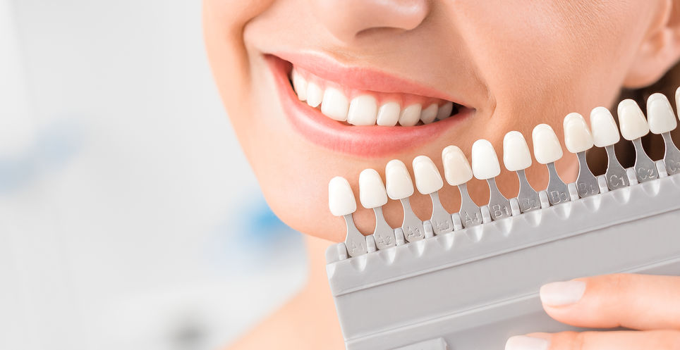 Are Veneers Really Worth It?