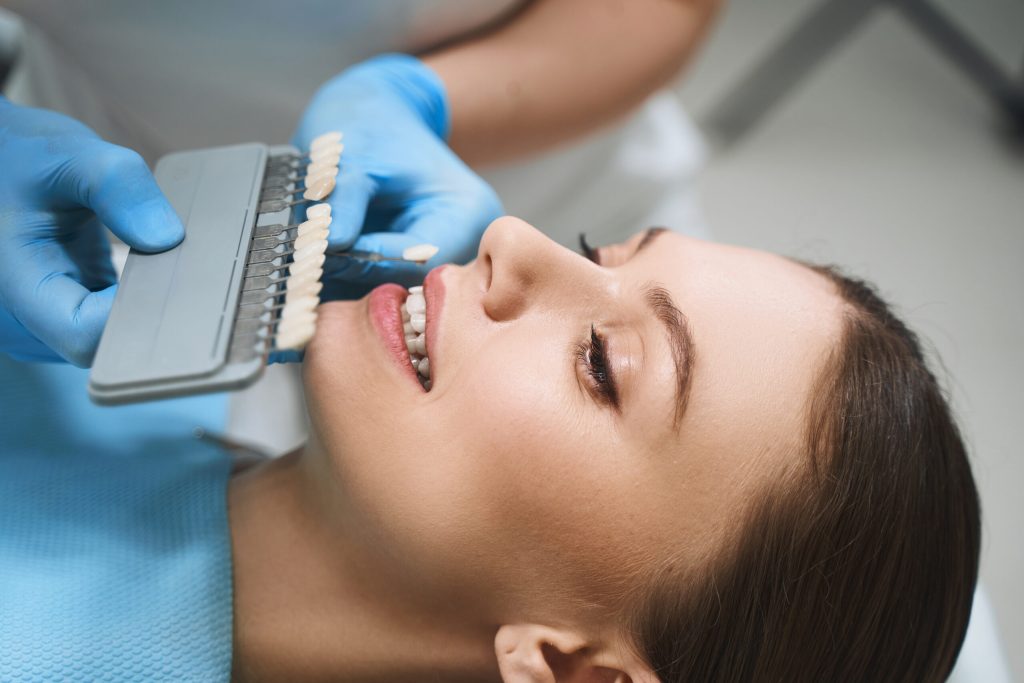 woman getting her veneers matched at dentist