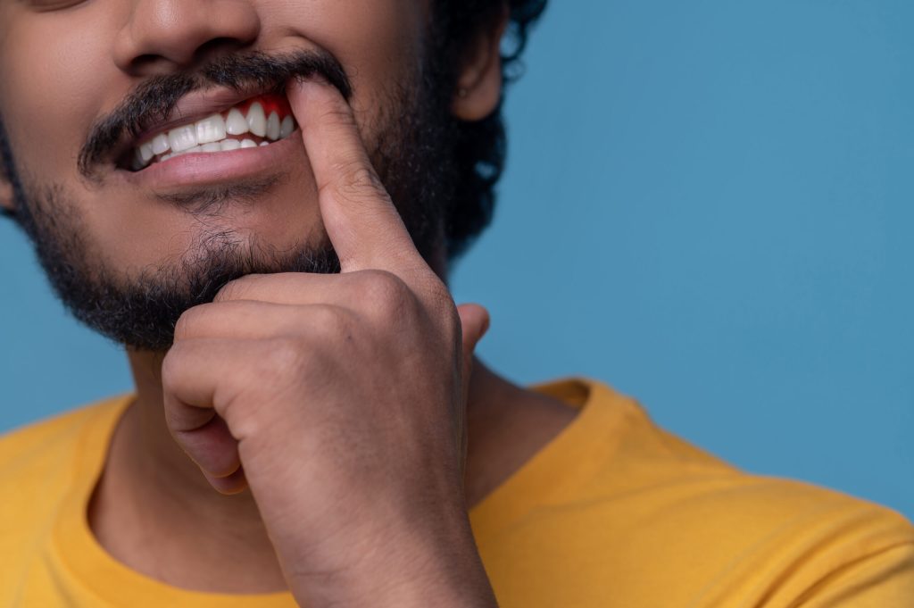 adult man showing his gums