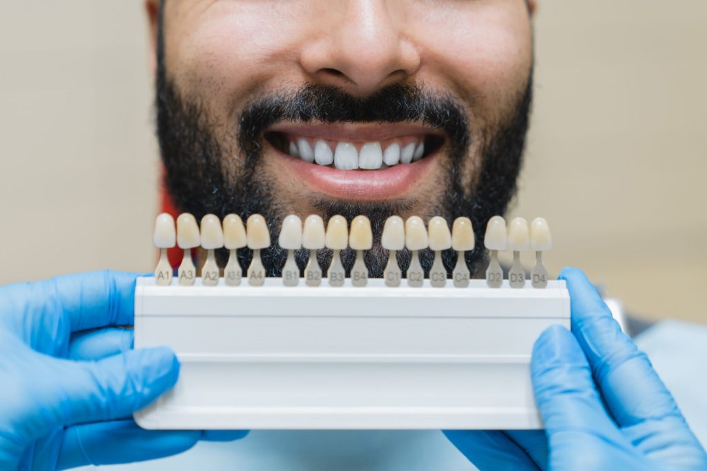 close up of mans smile with dental veneers held up in front of him